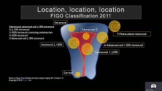 Ultrasound of the Myometrium by Mindy H Horrow MD FACR FSRU FAIUM [upl. by Ahsino976]