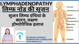 LYMPHADENOPATHY लिम्फ नोड की सूजन के कारन लक्षण व होम्योपैथिक इलाज  Homeopathy Lymph Node Swelling [upl. by Aliber635]