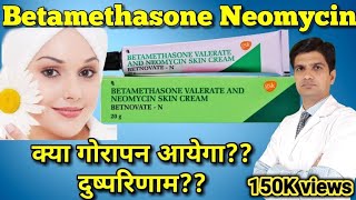 Betnovate N cream  Betamethasone Neomycin cream  betnovate n skin cream [upl. by Veriee433]