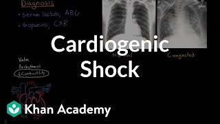 Cardiogenic shock  Circulatory System and Disease  NCLEXRN  Khan Academy [upl. by Namruht]