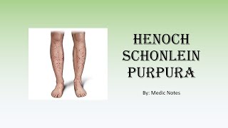 HenochSchonlein purpura  clinical features investigation treatment complication prognosis [upl. by Orravan]