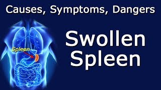 Swollen Spleen  Causes Symptoms Dangers [upl. by Eleonora]