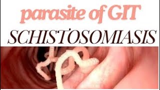 Parasitology Schistosomiasis 🪱part1 [upl. by Aleydis]