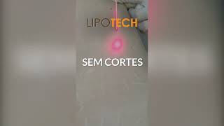 A LipoTech é a Lipo Sem Cortes da Fisioforma Procedimento Não Cirúrgico para remodelar o seu corpo [upl. by Kreit]