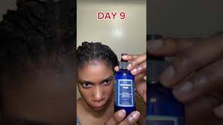 14 days hair growth progress with the super strength hair growth oil haircare hair hairgrowth [upl. by Danyelle593]