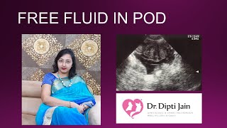 FREE FLUID IN POD IN ULTRASOUND english [upl. by Valina711]