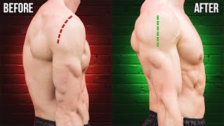 How I Fixed Rounded Shoulders Forever [upl. by Nedak324]