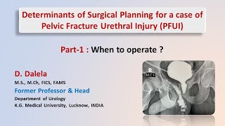 When to operate a case of Post Pelvic Fracture Urethral Injury [upl. by Giorgio]