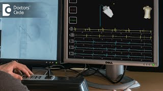 How is electrophysiology study done  Dr Mohammed Haroon Rashid [upl. by Agace914]