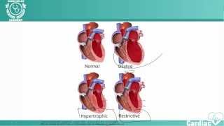 Cardiomyopathy  NCLEX® Cardiac Review  NURSINGcom NRSNG Academy [upl. by Ehrlich]