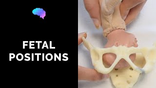 Types of Fetal Positions  OSCE Guide  UKMLA  CPSA [upl. by Ahselyt702]