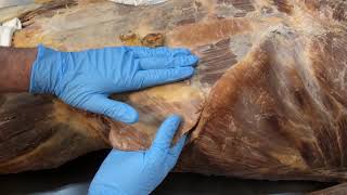 Anterior Abdominal Wall Muscles and the Abdominal Aponeurosis [upl. by Ylrebmik]