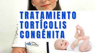 TRATAMIENTO TORTÍCOLIS CONGÉNITA [upl. by Aneloj]