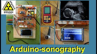 body ultrasound sonography with arduino  Sonographie mit Arduino [upl. by Anerdna93]