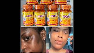 Vitamin C 1000mg Tablets codavailable [upl. by Thomasa]