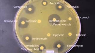 KirbyBauer Test timelapse with E  coli and S aureus [upl. by Admama]