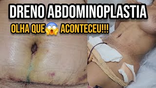 GUIA COMPLETO DRENO ABDOMINOPLASTIA Dicas Como usar e desentupir dreno pós operatório [upl. by Manuela320]