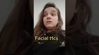 Facial Tics  Tic Example Video [upl. by Buller]