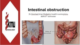 intestinal obstruction kmu 5 semester pediatric lecture no 5 gastrointestinal disease [upl. by Iphigenia179]