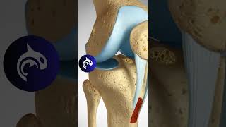 ACL Reconstruction  Patellar Harvest  3D Animation knee kneepain kneerehab [upl. by Guss112]