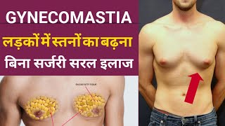 Gynecomastia को कैसे कम करें  Gynecomastia Treatment Without Surgery  How To Cure Gynecomastia [upl. by Racklin]