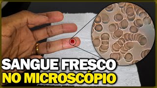 Analisando sangue fresco no microscópio [upl. by Ranit]