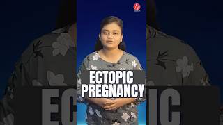 Ectopic Pregnancy by Ms Loveleen  NORCET 70 amp 80  NNL ONE  Nursing Next Live ectopicpregnancy [upl. by Cormack]