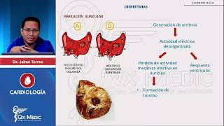 Fibrilación Auricular Flutter Auricular Bloqueos AV Extrasístoles Ventriculares [upl. by Anelrad]