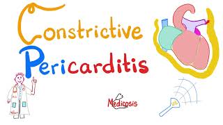 Constrictive Pericarditis  Causes Symptoms Signs Diagnosis amp Management  Cardiology [upl. by Therine]