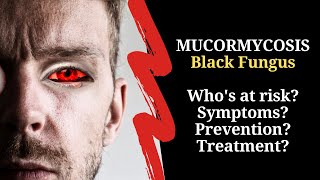 BLACK FUNGUS disease Mucormycosis  All you need to know [upl. by Nnorahs]