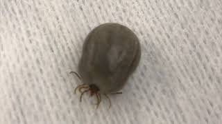 Paralysis Tick taken off cat [upl. by Tiena560]