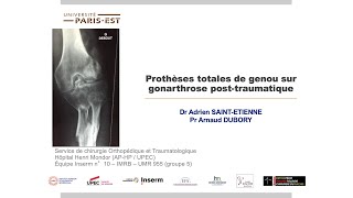 7  PTG sur gonarthrose post traumatique [upl. by Jessamine531]