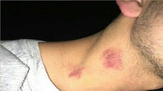 how to give your boyfriend a hickey for the first time [upl. by Hitchcock]