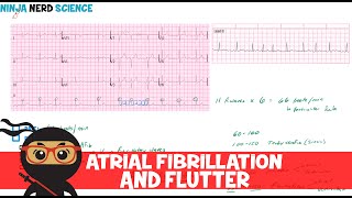 Rate and Rhythm  Atrial Fibrillation and Atrial Flutter [upl. by Anatsirhc917]