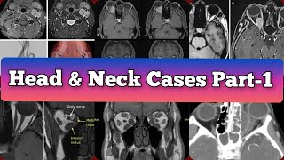 Radiology Viva Cases  367 375  Head and Neck Exam Cases Part 1 medical radiology [upl. by Nesnar873]