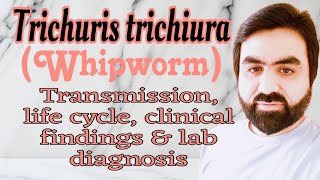 Lec26  Trichuris trichiura  Whipworm  Transmission  life cycle  clinical findings  UrduHindi [upl. by Calore]