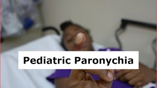 Pediatric Paronychia Drainage [upl. by Morehouse]