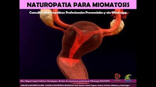 CURSO GRATUITO HERBOLARIA MUJER MIOMATOSIS UTERINA [upl. by Artkele]