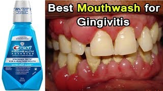 Top 3 Best Mouthwashes for Gingivitis Disease  Periodontal Disease [upl. by Crellen]