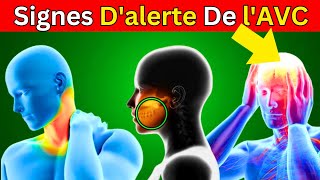 7 Symptômes de lAVC Ce que Vous Devez Savoir [upl. by Aneert577]