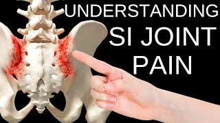 Simple Solutions to Sacroiliac SI Joint Pain [upl. by Sedecrem322]