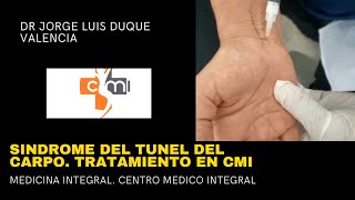 SINDROME TUNEL CARPIANO TRATAMIENTO CMI [upl. by Adnohsat]