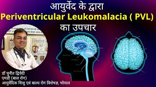 Periventricular Leukomalacia  Causes Symptoms and Treatment in Ayurveda  डॉ पुनीत द्विवेदी [upl. by Eelloh710]