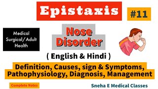 Epistaxis in Hindi  Causes  Sign amp Symptoms  Pathophysiology Diagnosis Management [upl. by Ssegrub21]