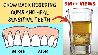 Heal Receding Gums and Grow Back  Treat Sensitive Teeth and Reverse Receding Gums  Gingivitis [upl. by Ikcim58]