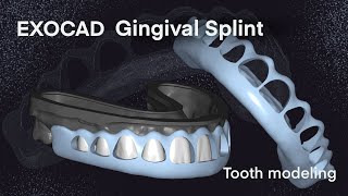 Exocad Gingival splint I Tooth Modeling 31 [upl. by Danice]