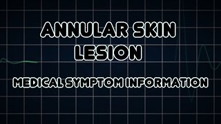 Annular skin lesion Medical Symptom [upl. by Eidson]