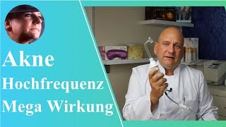 Hochfrequenz in der Aknebehandlung  pickel aknebehandlung hfstab akne [upl. by Weiman]