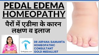 Top 2  Homeopathy Medicines for WeightGain  Dr PS Tiwari [upl. by Egres]