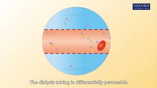 Animation E1 12 How does a dialysis machine work [upl. by Lothaire]